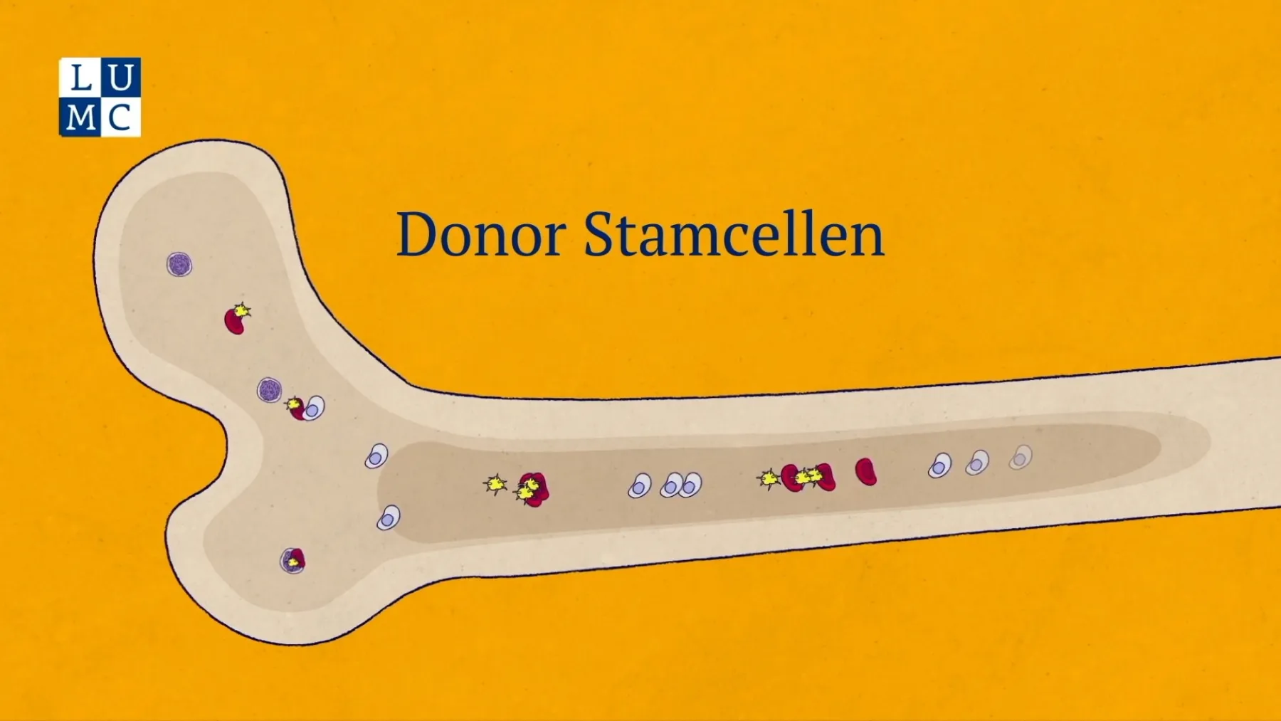 Wat is een stamceltransplantatie: animatie still